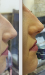 Profesionalne zabiegi medycyny estetycznej na każdą kieszeń - czy to możliwe? 