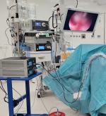 Kliniczne Centrum w Opolu zyskało najnowocześniejszy histeroskop