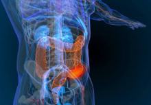 Naukowcy odkryli zmiany zwiastujące raka jelita grubego. Mogą pojawiać się lata przed chorobą