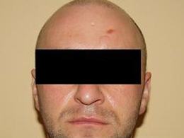 34-letni mieszkaniec Opola odpowie za rozbój.