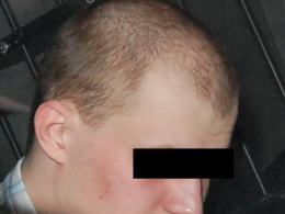 22-letni Damian B. kierował samochodem, mając w sobie ponad 2 promile alkoholu.