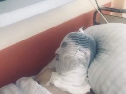 Czteroosobowa rodzina straciła cały dobytek podczas pożaru na Walecki. 22-latek w śpiączce