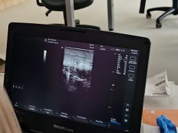 Oncoday na Uniwersytecie Opolskim: Edukacja i profilaktyka onkologiczna