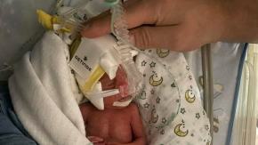 620 gramów i 29. tydzień ciąży. Po 85 dniach Antoś wrócił do domu