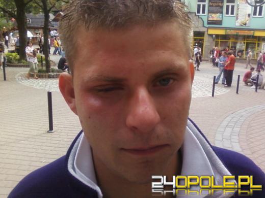 Opolanin: Zostałem pobity przez Peję