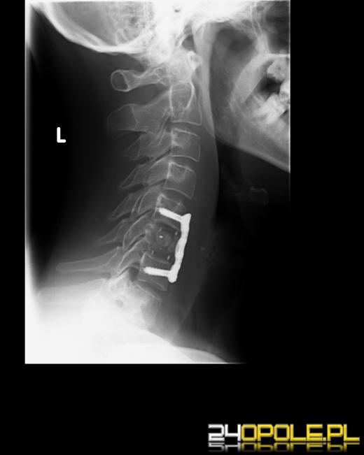 Płytka wyobraźnia przyczyną kalectwa