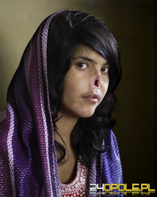 Najlepsze fotografie świata - World Press Photo w Opolu