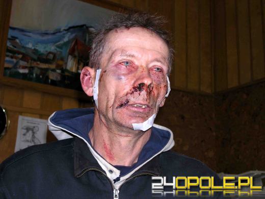 Zaatakowany mężczyzna ledwo uszedł z życiem