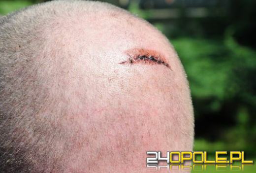 Rozróba w kurdyjskim barze na Rynku. Dwie wersje wydarzeń