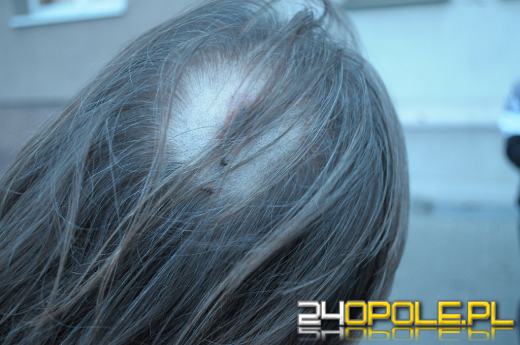 Ranił taksówkarza siekierką w głowę. Próba morderstwa czy chuligański wybryk?