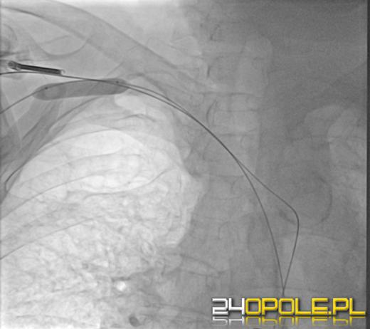 Lekarze z Uniwersyteckiego Szpitala Klinicznego przeprowadzili nowatorski zabieg kardiologiczny 