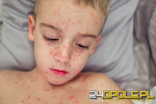 Posypią się mandaty dla rodziców, którzy nie szczepią dzieci