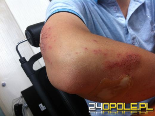 Wyższe odszkodowania z ZUS za wypadki przy pracy od kwietnia