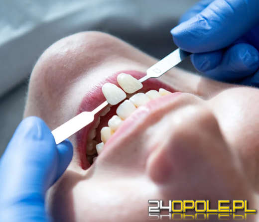 Czym są licówki porcelanowe i jak się je zakłada?