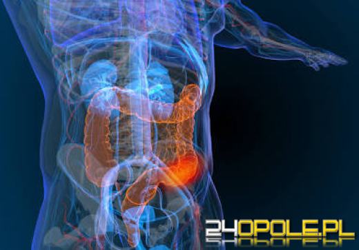 Naukowcy odkryli zmiany zwiastujące raka jelita grubego. Mogą pojawiać się lata przed chorobą