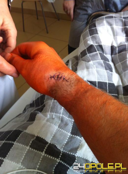 Bartłomiej Bonk zdobywał medale z kontuzją nadgarstka