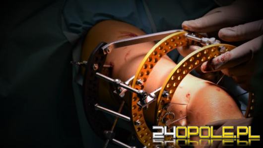 To pierwszy na Opolszczyźnie zabieg wykonany tą metodą. 11-latka przeszła operację w USK