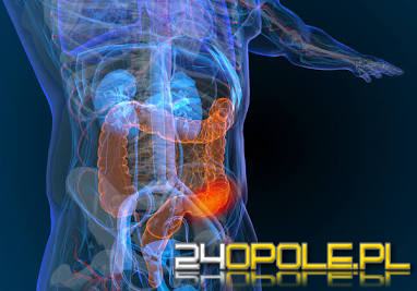 Naukowcy odkryli zmiany zwiastujące raka jelita grubego. Mogą pojawiać się lata przed chorobą